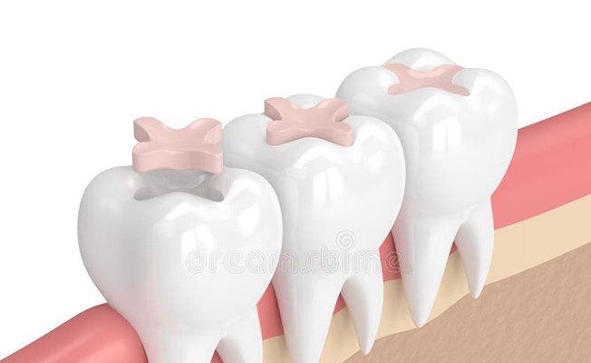 Dental consultation