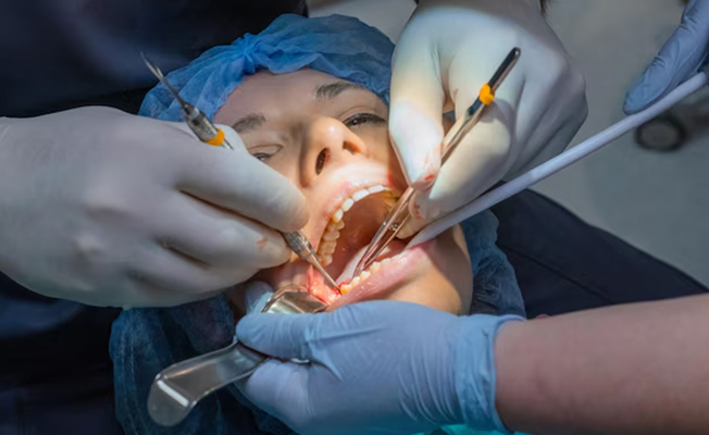 Denture fabrication